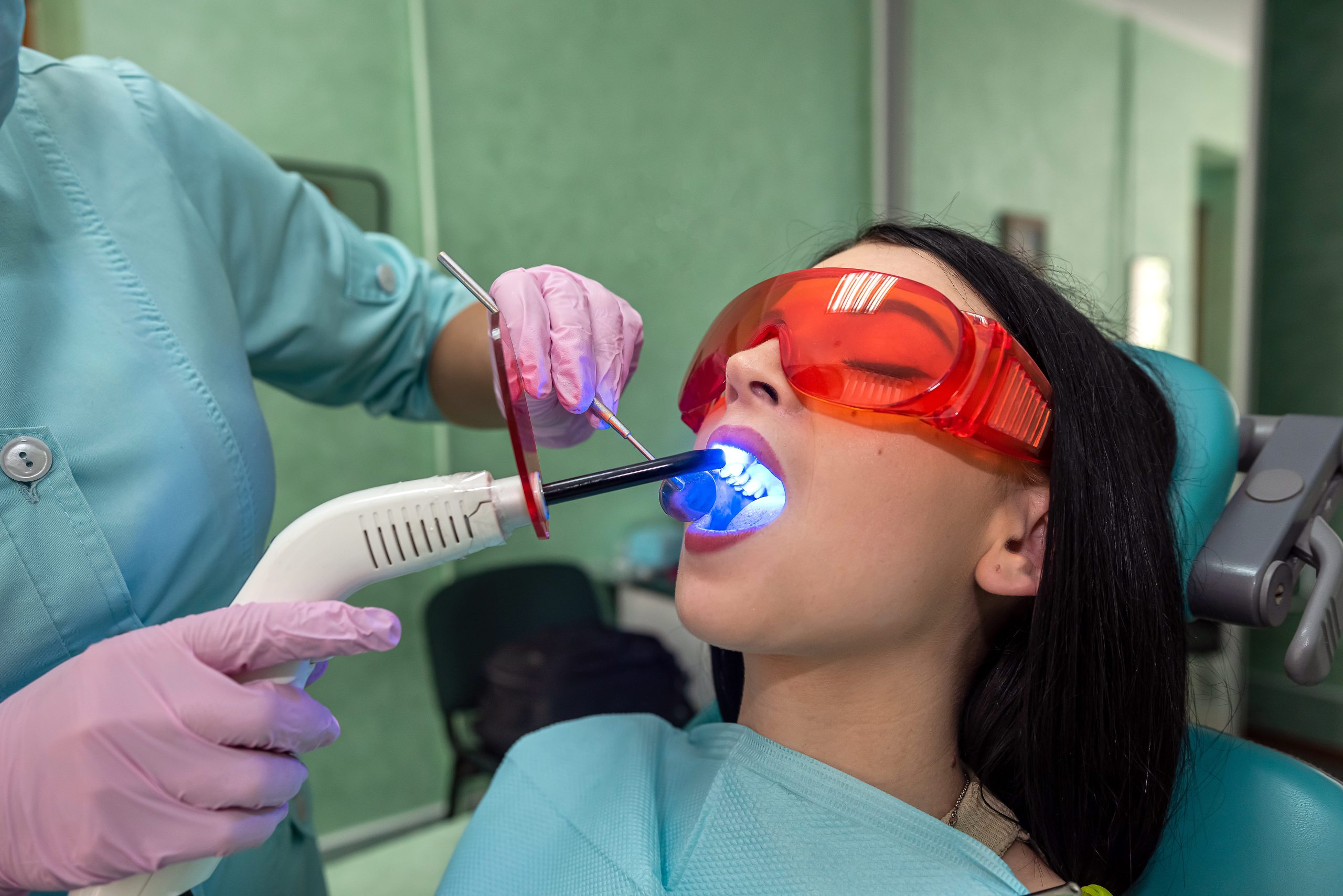 Лечение глубокого кариеса с постановкой пломбы световой полимеризации «Filtek», «Esthet» (анестезия, формирование полости, наложение лечебной прокладки, постановка пломбы, полировка)